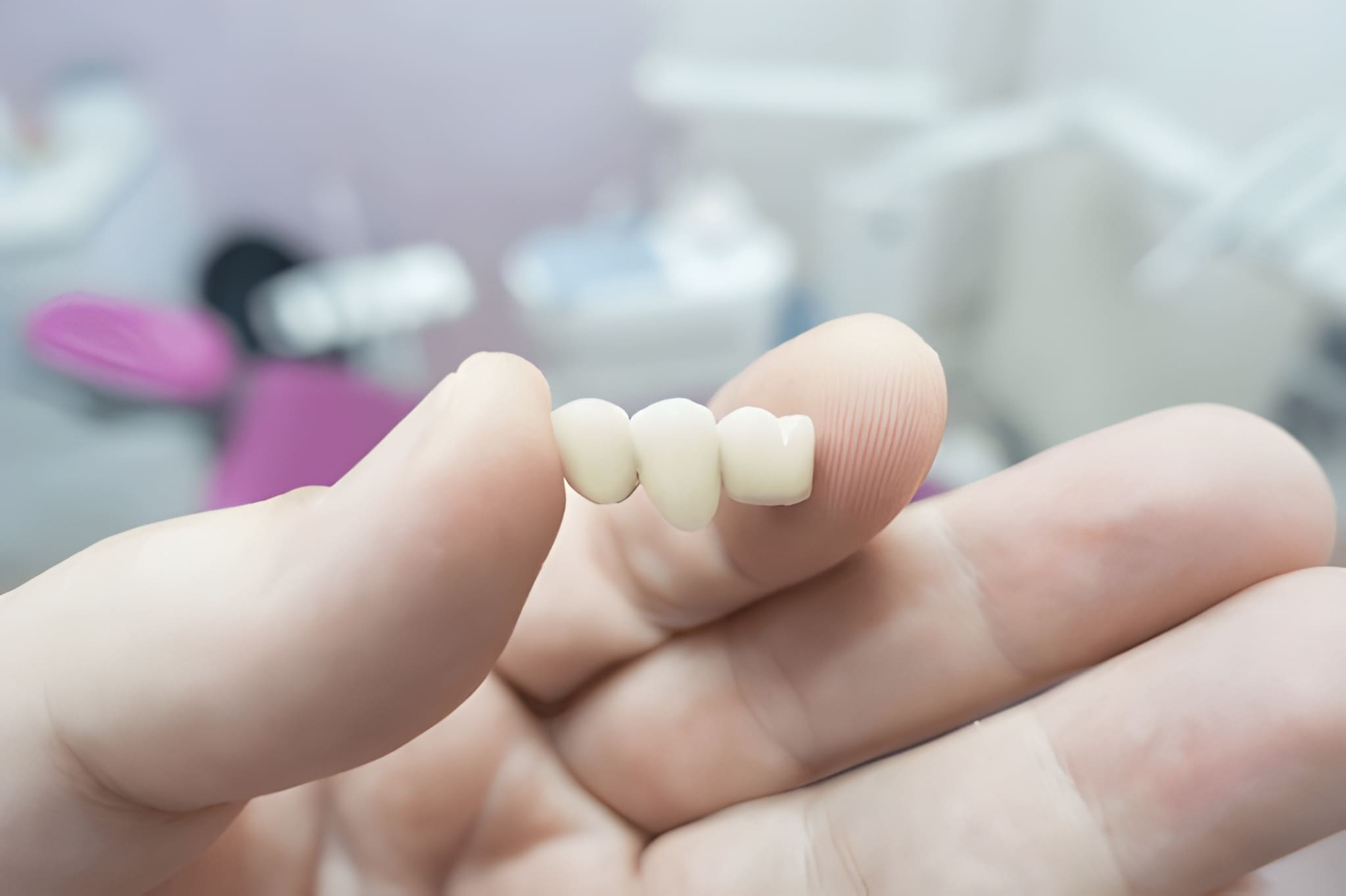 dental bridges near you