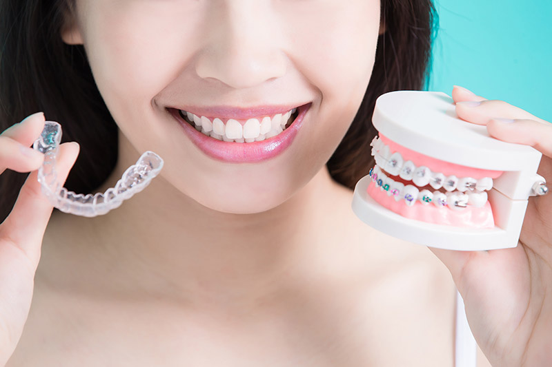 invisalign in airdrie