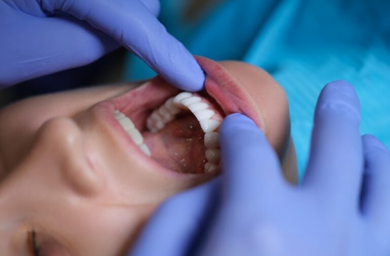oral cancer screening in airdrie