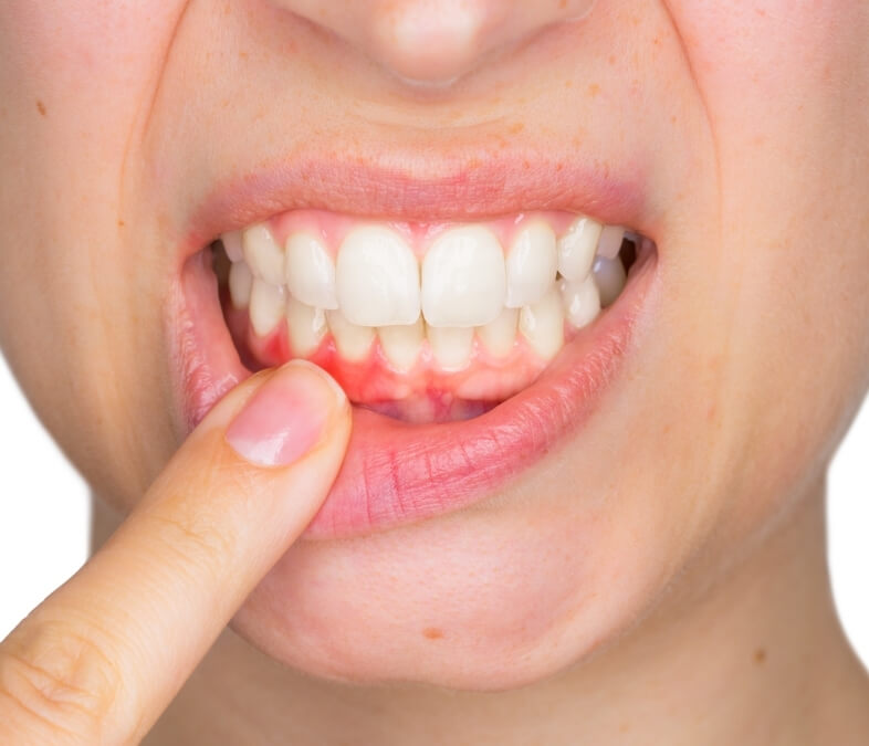 oral cancer screening near you