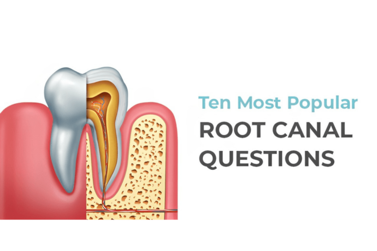 Commonly Asked Root Canal Procedure Questions