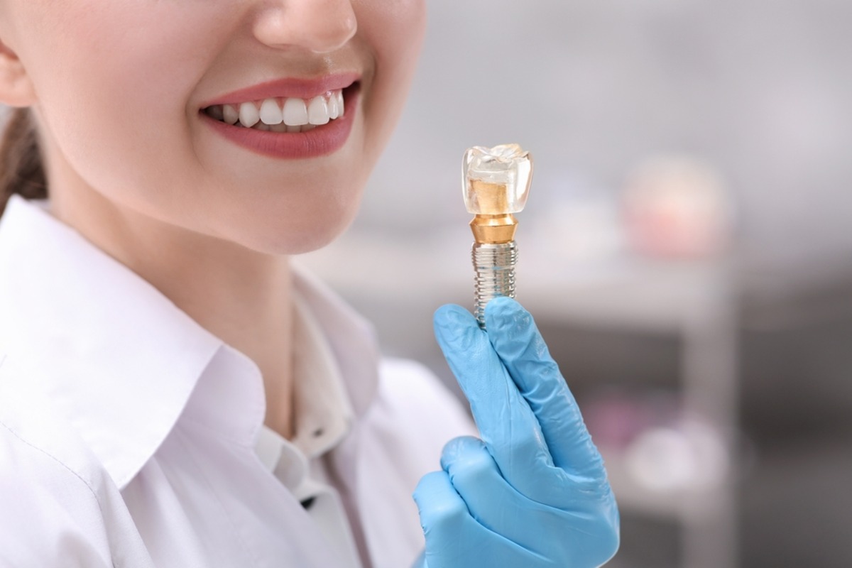 top reasons to choose dental implants for tooth replacement