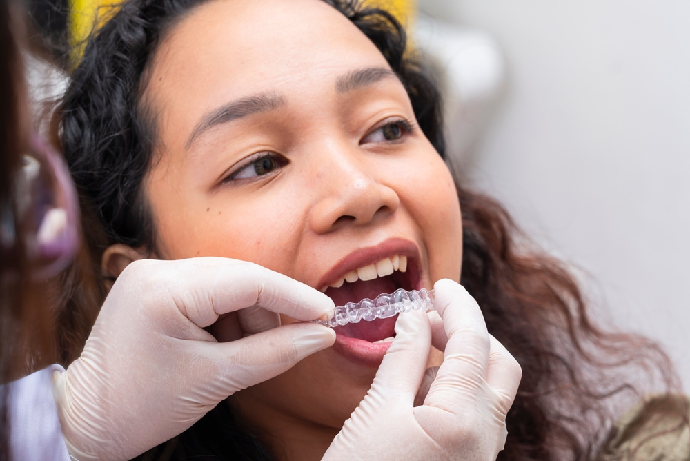 can invisalign fix overbite underbite or gaps