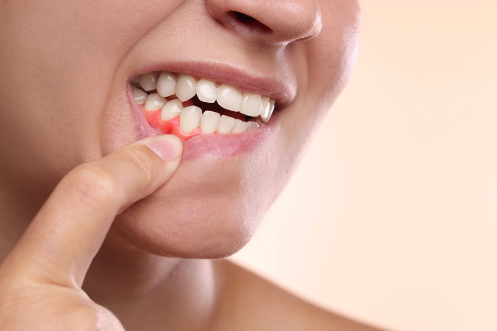 dentist explains why gums look pale
